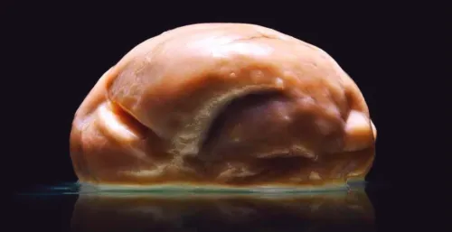 Как живут люди без мозга