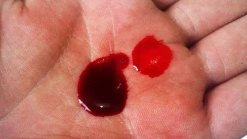 5 самых мерзких серийных убийц в истории