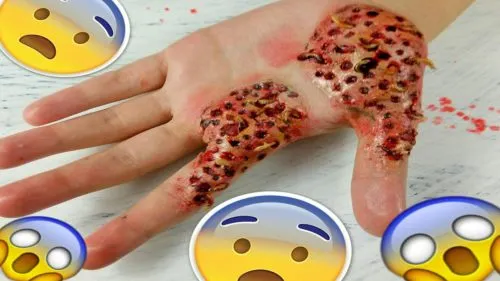 Боязнь отверстий трипофобия – реальное заболевание или самовнушение?