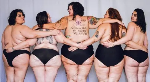 Изи складка. Почему бодипозитив – это не про жиробасов