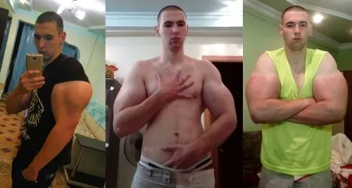 «Хана базукам». Возможно, синтольщик Кирилл Терешин избавился от рук-пузырей