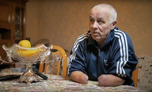 На безрукого инвалида завели уголовное дело – он душил полицейского руками. ¯\_(ツ)_/¯