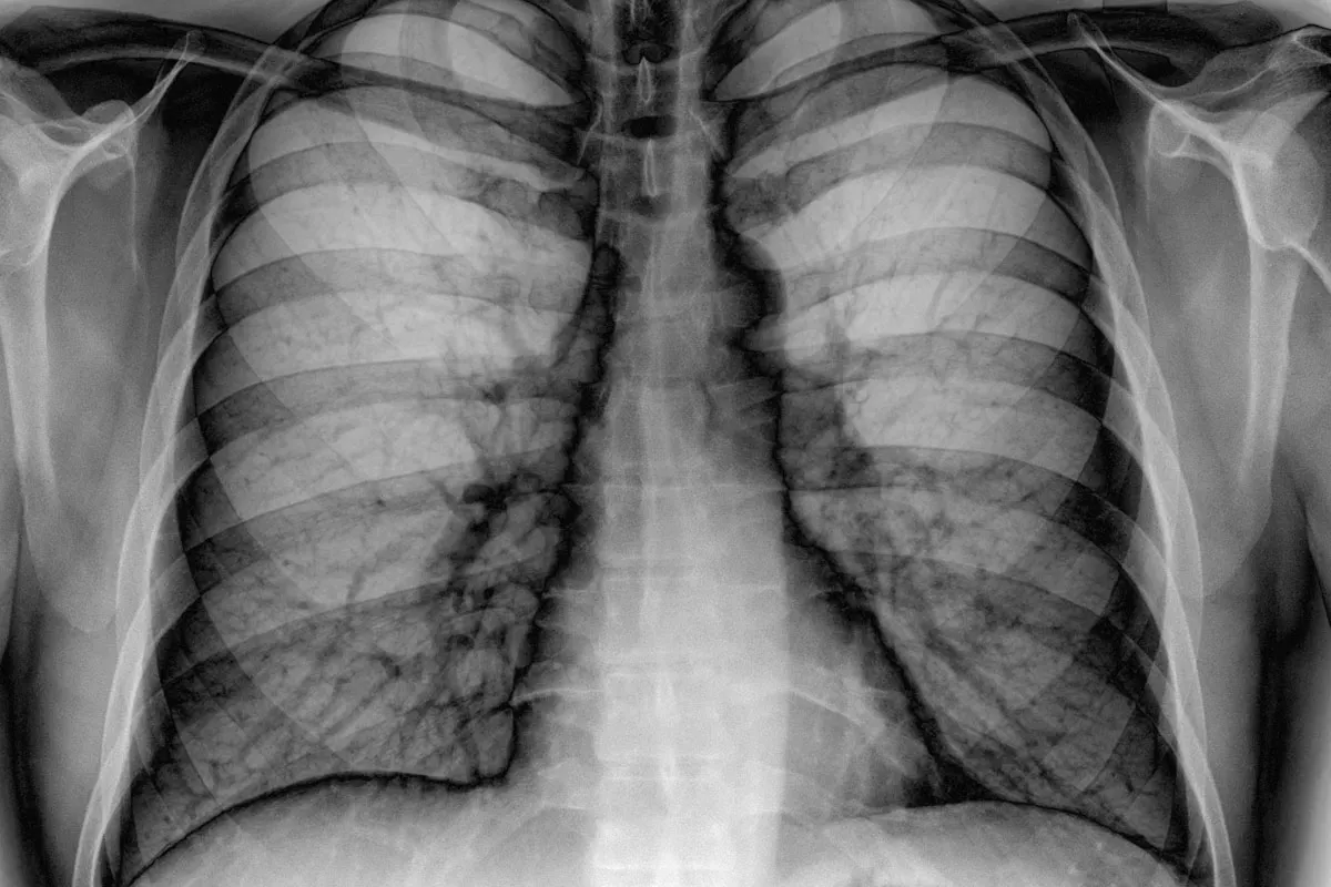 Тайна питерской флюорографии на Восстания. Это гениально!