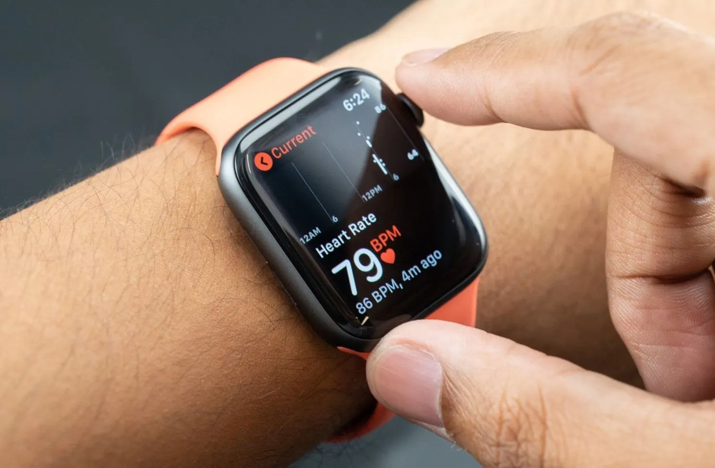 Какое излучение у Xiaomi Mi Band и других браслетов? Отвечает кардиолог